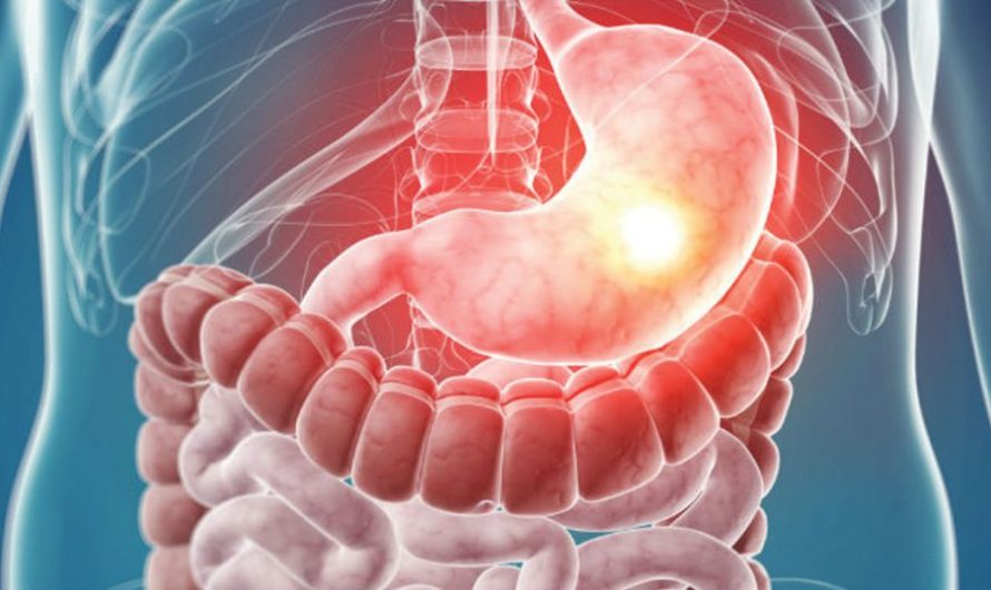 Wellhealthorganic.com : Key Signs of Gastroenteritis | गैस्ट्रोएंटेराइटिस क्या है?